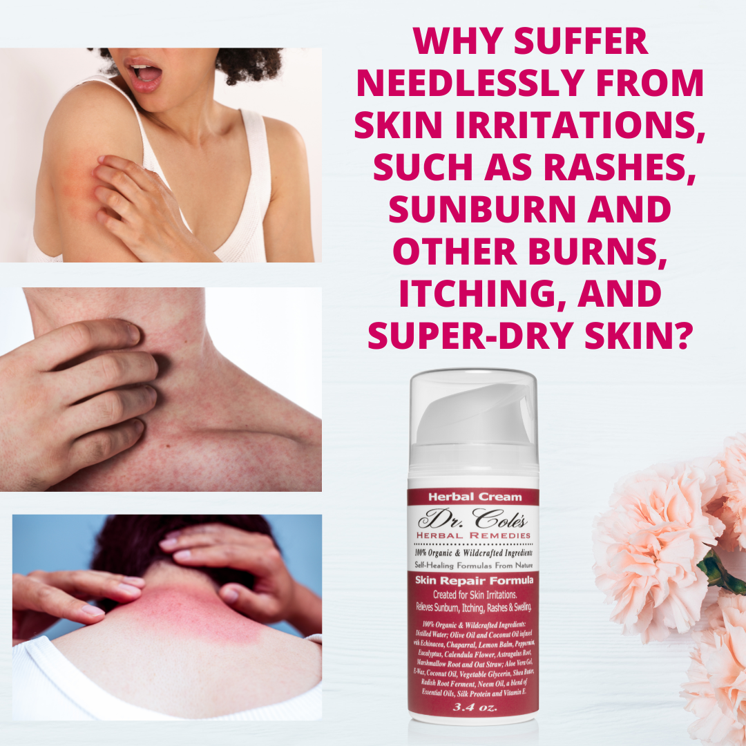 Why suffer from skin irritations, rashes, sunburn and itching when you can use Dr. Cole's Herbal Remedies Skin Repair Formula Cream?