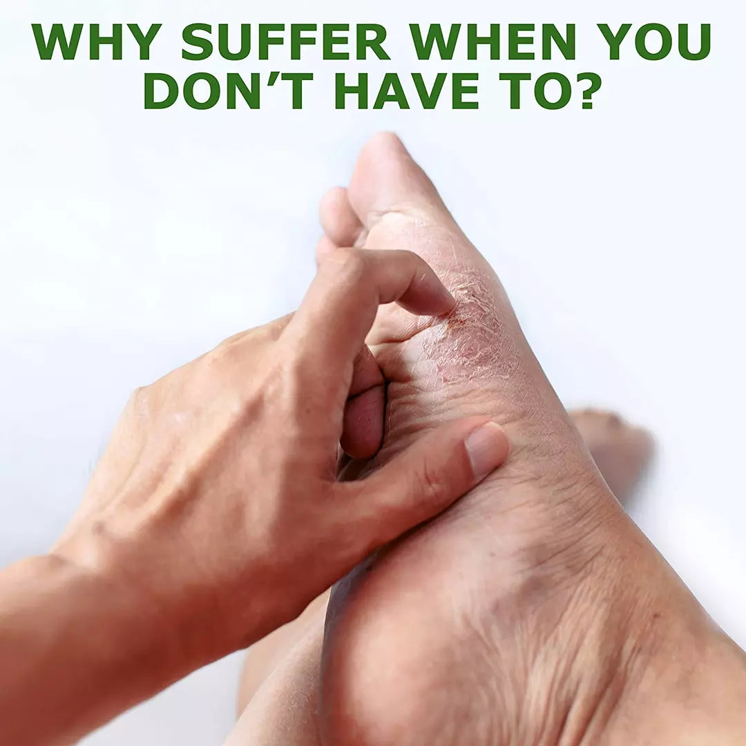 Dr. Cole's Antifungal Balm SixPak
