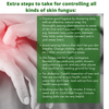 Dr. Cole's Organic Athlete’s Foot Treatment