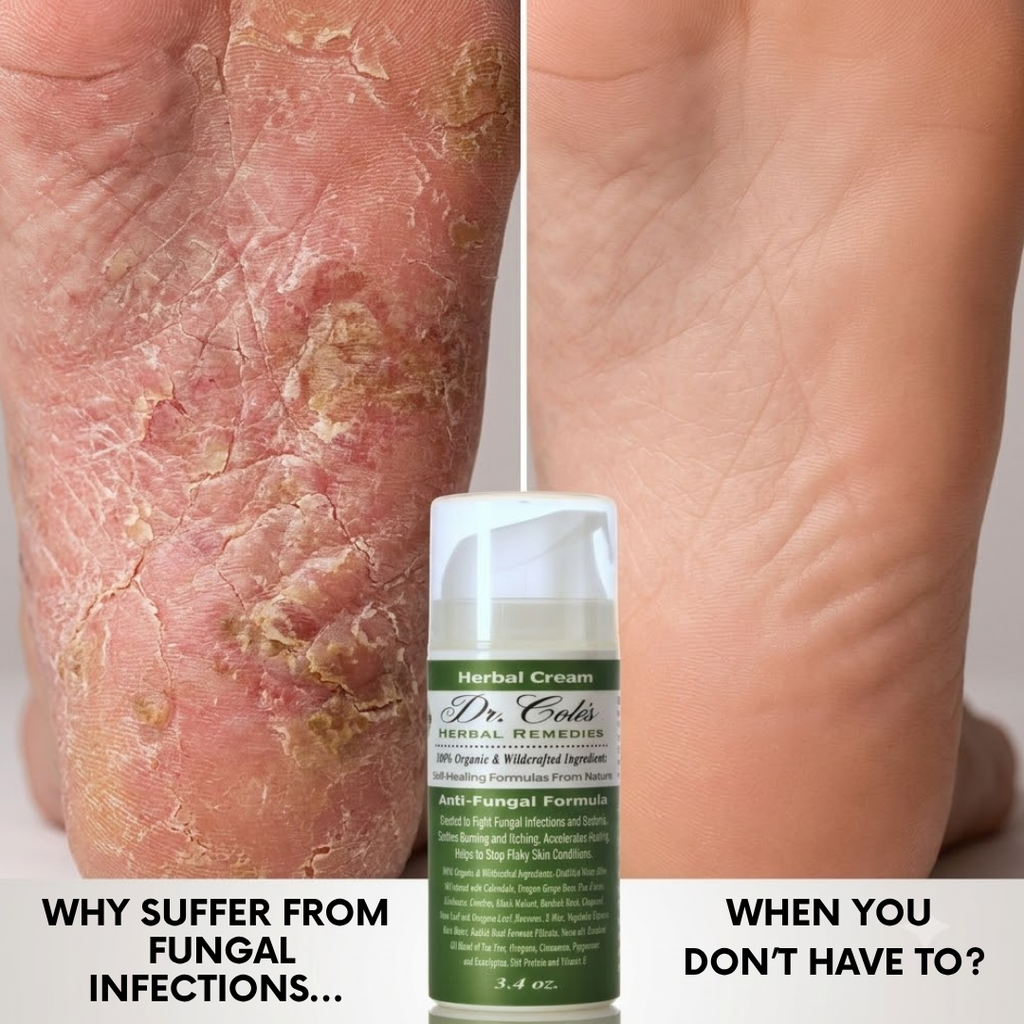 08 - Dr. Cole's Anti-Fungal Cream
