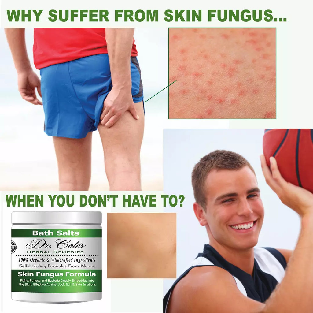 Dr. Cole’s Organic Anti-fungal Skin Soaking Salts